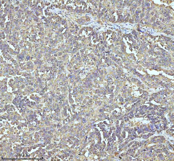 2 - Anti-Stathmin 1 STMN1 Rabbit Monoclonal Antibody ABO14029