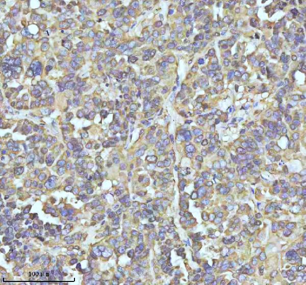 2 - Anti-Stathmin 1 STMN1 Rabbit Monoclonal Antibody ABO14029