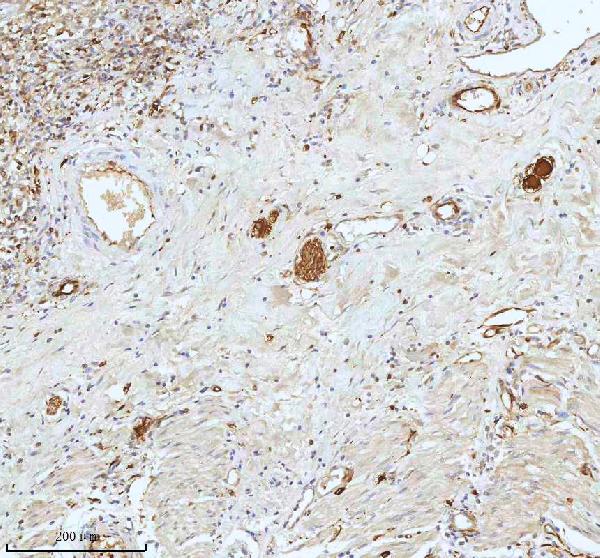 2 - Anti-Stathmin 1 STMN1 Rabbit Monoclonal Antibody ABO14029