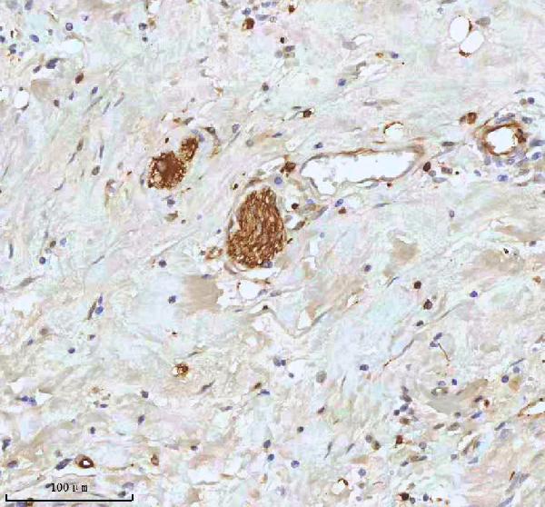 2 - Anti-Stathmin 1 STMN1 Rabbit Monoclonal Antibody ABO14029