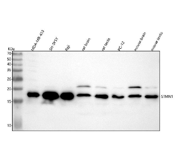 1 - Anti-Stathmin 1 STMN1 Rabbit Monoclonal Antibody ABO14029
