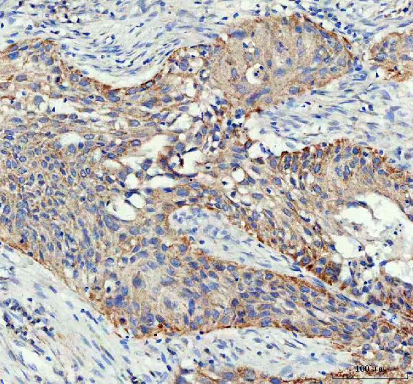 2 - Anti-Prohibitin PHB Rabbit Monoclonal Antibody ABO14030