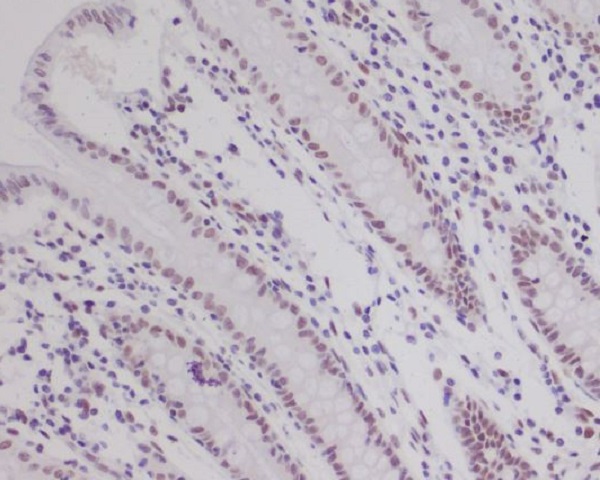 2 - Anti-HIF-1 beta ARNT Rabbit Monoclonal Antibody ABO14031