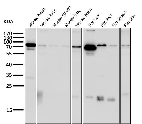 1 - Anti-HIF-1 beta ARNT Rabbit Monoclonal Antibody ABO14031
