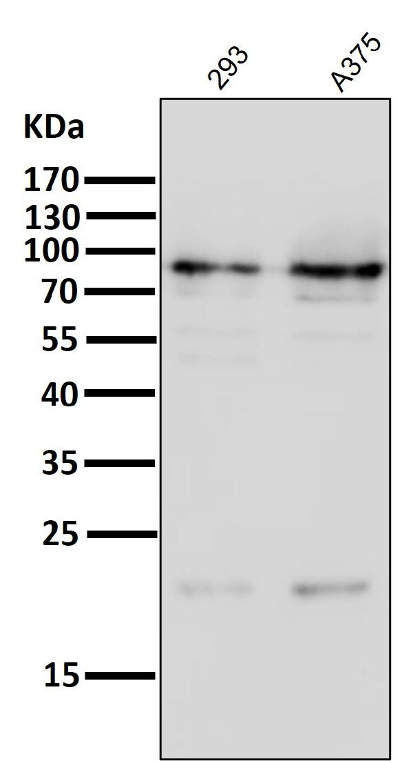 1 - Anti-HIF-1 beta ARNT Rabbit Monoclonal Antibody ABO14031