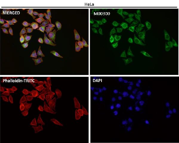 1 - Anti-p62/SQSTM1 Rabbit Monoclonal Antibody ABO14032