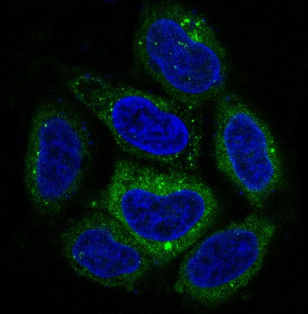 3 - Anti-p62/SQSTM1 Rabbit Monoclonal Antibody ABO14032