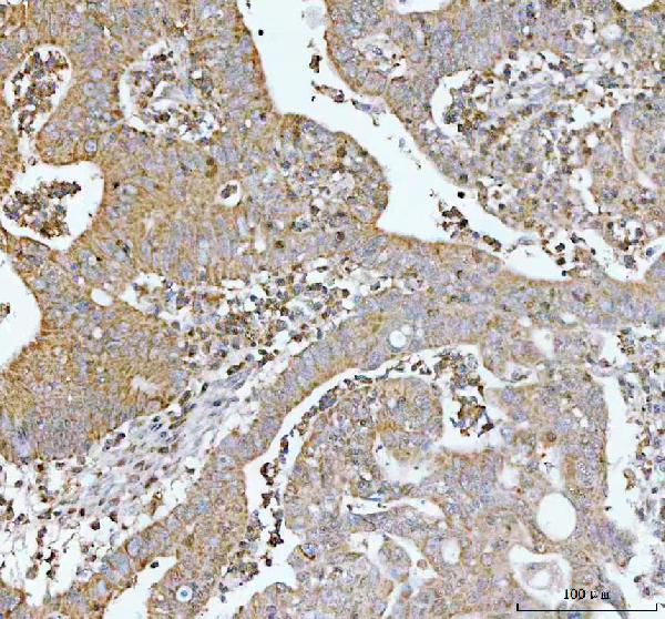 2 - Anti-p62/SQSTM1 Rabbit Monoclonal Antibody ABO14032