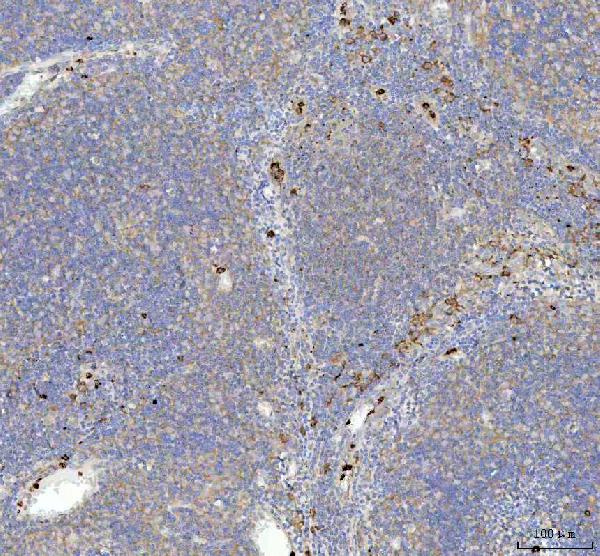 2 - Anti-p62/SQSTM1 Rabbit Monoclonal Antibody ABO14032