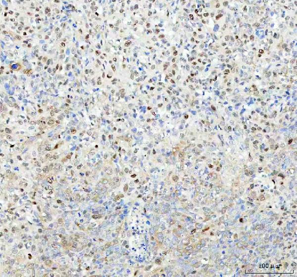 2 - Anti-p62/SQSTM1 Rabbit Monoclonal Antibody ABO14032