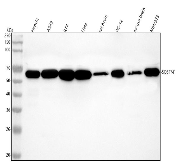 1 - Anti-p62/SQSTM1 Rabbit Monoclonal Antibody ABO14032