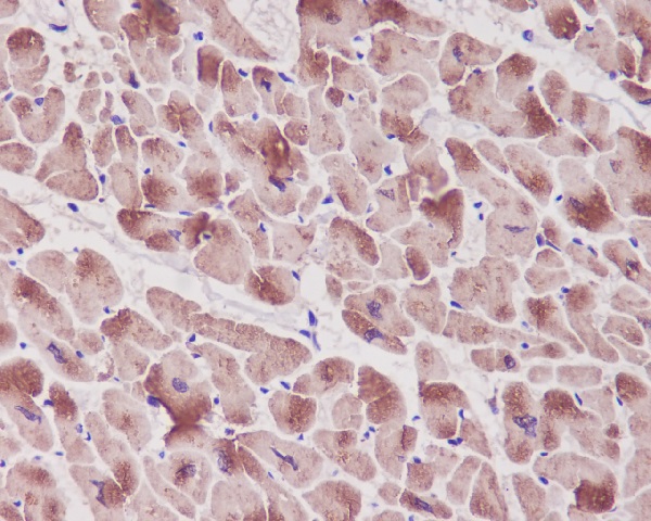 2 - Anti-Troponin I Rabbit Monoclonal Antibody ABO14033
