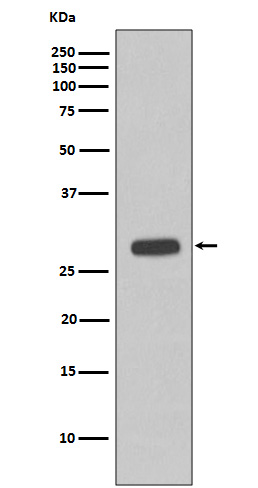 1 - Anti-Troponin I Rabbit Monoclonal Antibody ABO14033