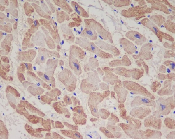 2 - Anti-Troponin T TNNT2 Rabbit Monoclonal Antibody ABO14034