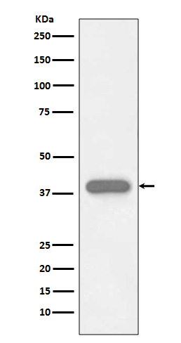 1 - Anti-Troponin T TNNT2 Rabbit Monoclonal Antibody ABO14034