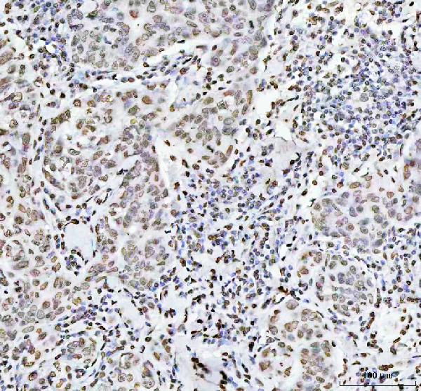 2 - Anti-Histone H4 HIST1H4A Rabbit Monoclonal Antibody ABO14036