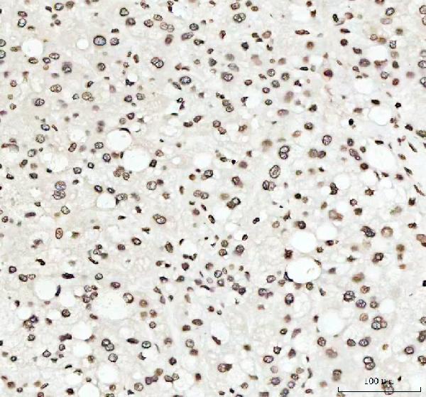 2 - Anti-Histone H4 HIST1H4A Rabbit Monoclonal Antibody ABO14036