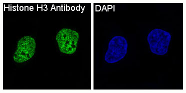 3 - Anti-Histone H3 HIST1H3A Rabbit Monoclonal Antibody ABO14037