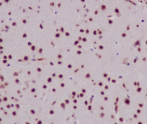 2 - Anti-Histone H3 HIST1H3A Rabbit Monoclonal Antibody ABO14037