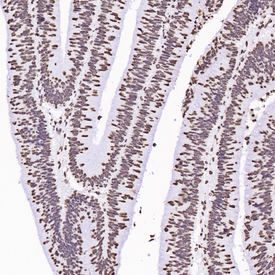 2 - Anti-Histone H3 HIST1H3A Rabbit Monoclonal Antibody ABO14037