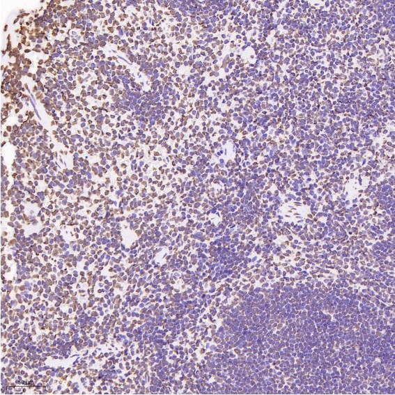 2 - Anti-Histone H3 HIST1H3A Rabbit Monoclonal Antibody ABO14037