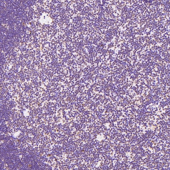 2 - Anti-Histone H3 HIST1H3A Rabbit Monoclonal Antibody ABO14037