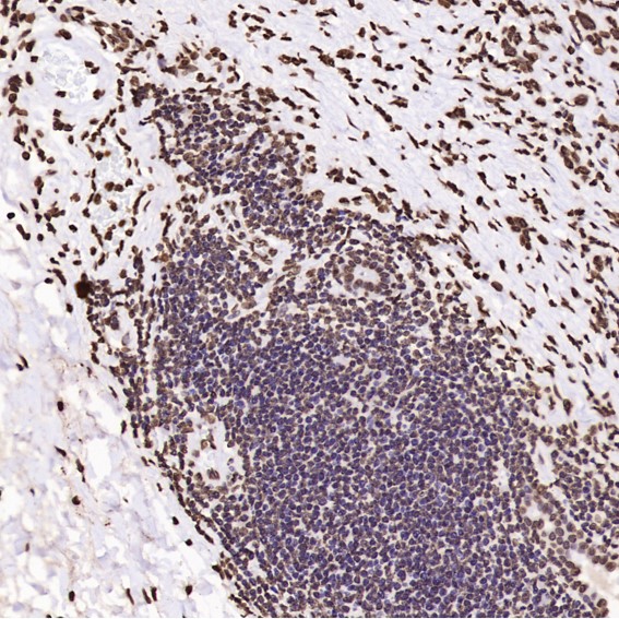 2 - Anti-Histone H3 HIST1H3A Rabbit Monoclonal Antibody ABO14037