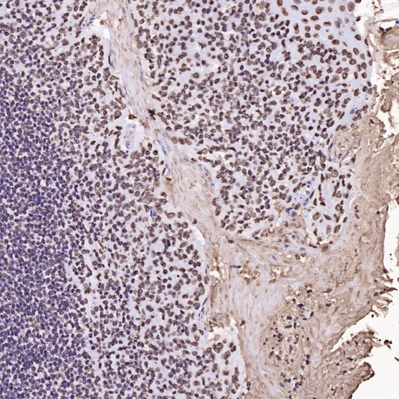 2 - Anti-Histone H3 HIST1H3A Rabbit Monoclonal Antibody ABO14037