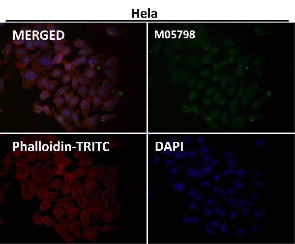 1 - Anti-Cdc23/APC8 Rabbit Monoclonal Antibody ABO14040