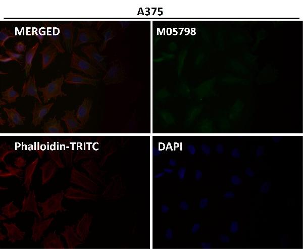1 - Anti-Cdc23/APC8 Rabbit Monoclonal Antibody ABO14040