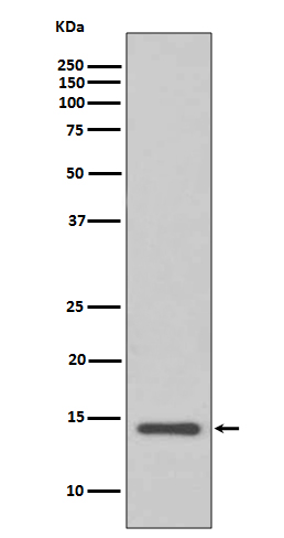 1 - Anti-Cystatin C CST3 Rabbit Monoclonal Antibody ABO14043