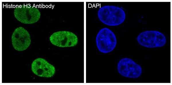 3 - Anti-Histone H3 HIST1H3A Rabbit Monoclonal Antibody ABO14044