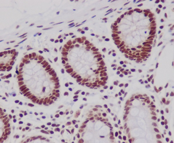 2 - Anti-Histone H3 HIST1H3A Rabbit Monoclonal Antibody ABO14044