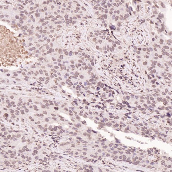 2 - Anti-Histone H3 HIST1H3A Rabbit Monoclonal Antibody ABO14044