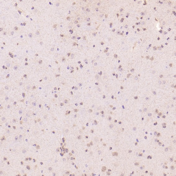 2 - Anti-Histone H3 HIST1H3A Rabbit Monoclonal Antibody ABO14044