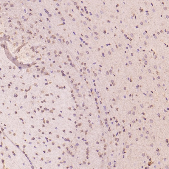 2 - Anti-Histone H3 HIST1H3A Rabbit Monoclonal Antibody ABO14044