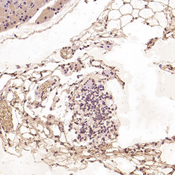 2 - Anti-Histone H3 HIST1H3A Rabbit Monoclonal Antibody ABO14044