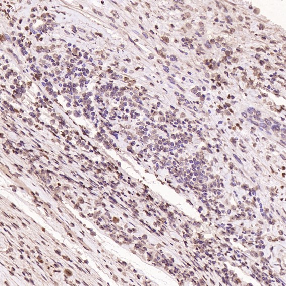 2 - Anti-Histone H3 HIST1H3A Rabbit Monoclonal Antibody ABO14044