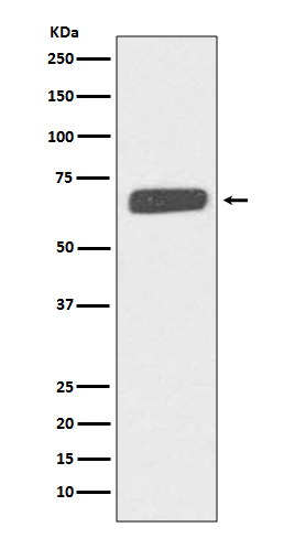 1 - Anti-Collagen X COL10A1 Rabbit Monoclonal Antibody ABO14046