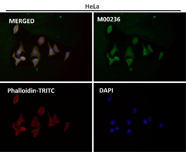 1 - Anti-PGC1 alpha PPARGC1A Rabbit Monoclonal Antibody ABO14047