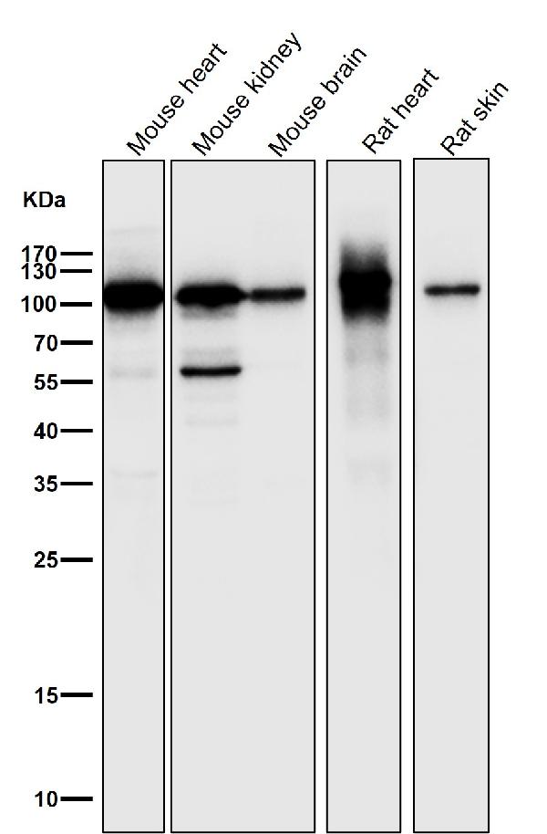 1 - Anti-PGC1 alpha PPARGC1A Rabbit Monoclonal Antibody ABO14047