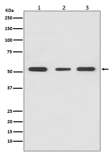 1 - Anti-PPAR gamma Rabbit Monoclonal Antibody ABO14048