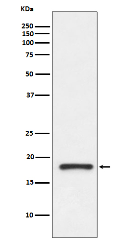 1 - Anti-Prealbumin TTR Rabbit Monoclonal Antibody ABO14049