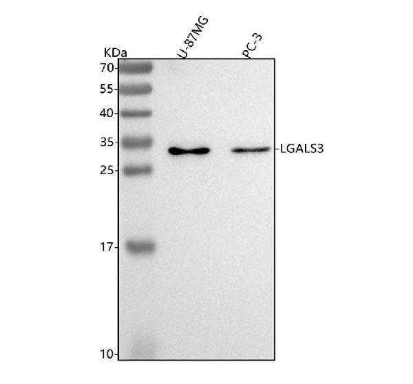 1 - Anti-Galectin 3 LGALS3 Rabbit Monoclonal Antibody ABO14051