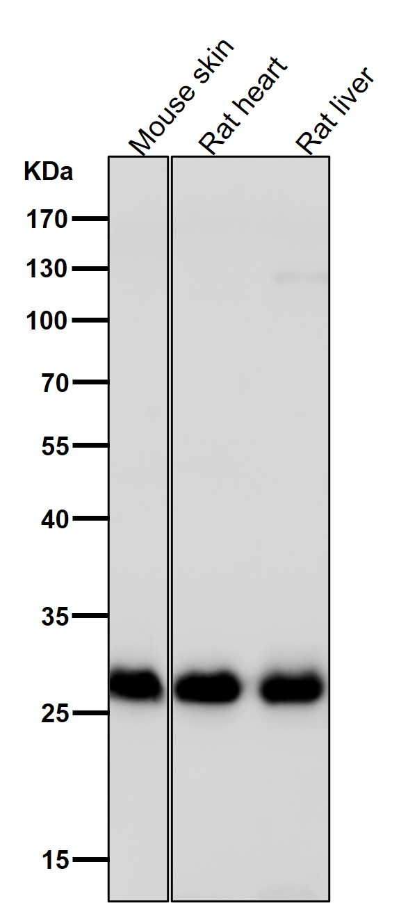 1 - Anti-Galectin 3 LGALS3 Rabbit Monoclonal Antibody ABO14051