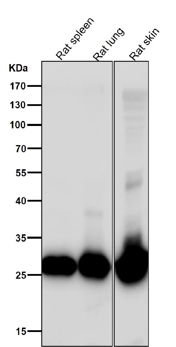 1 - Anti-Galectin 3 LGALS3 Rabbit Monoclonal Antibody ABO14051