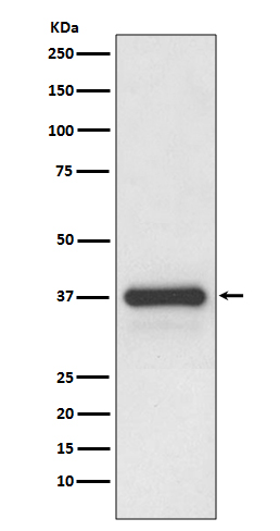 1 - Anti-Podoplanin PDPN Rabbit Monoclonal Antibody ABO14052