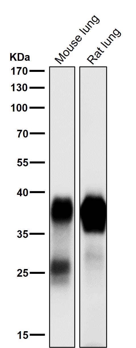 1 - Anti-Podoplanin PDPN Rabbit Monoclonal Antibody ABO14052