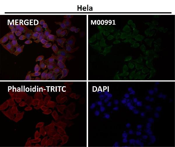 1 - Anti-Syndecan 1 SDC1 Rabbit Monoclonal Antibody ABO14053