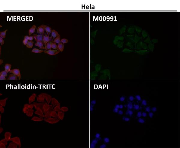 1 - Anti-Syndecan 1 SDC1 Rabbit Monoclonal Antibody ABO14053